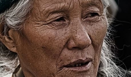 Wrinkles On A Skinny Face