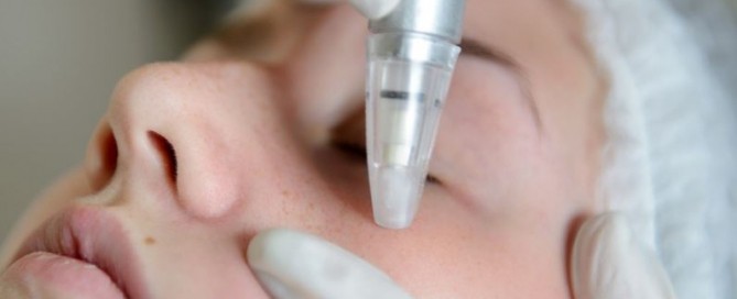 Microdermabrasion